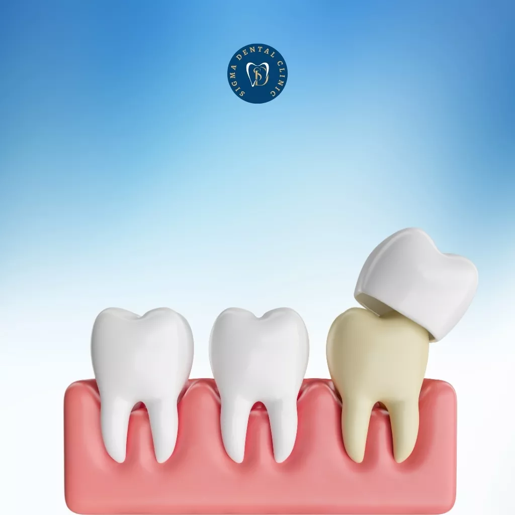 How to Care for a Dental Crown | Chicago IL | Call : (773) 506-2033