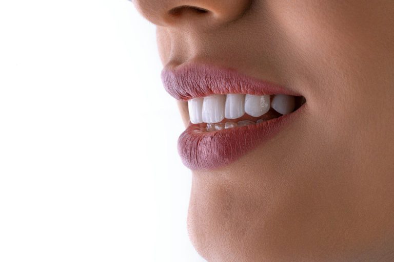 Close-up of a bright white smile after professional teeth whitening